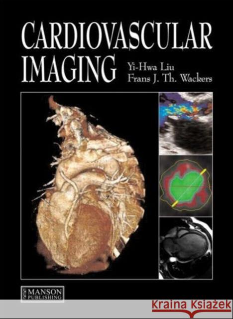 Cardiovascular Imaging Yi-Hwa Liu Frans J. Wackers 9781840761092 MANSON PUBLISHING LTD