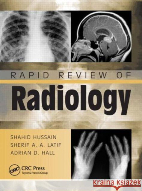 Rapid Review of Radiology Adrian David Hall 9781840761207