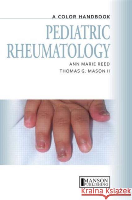 Pediatric Rheumatology : A Color Handbook Ann Marie Reed 9781840761573