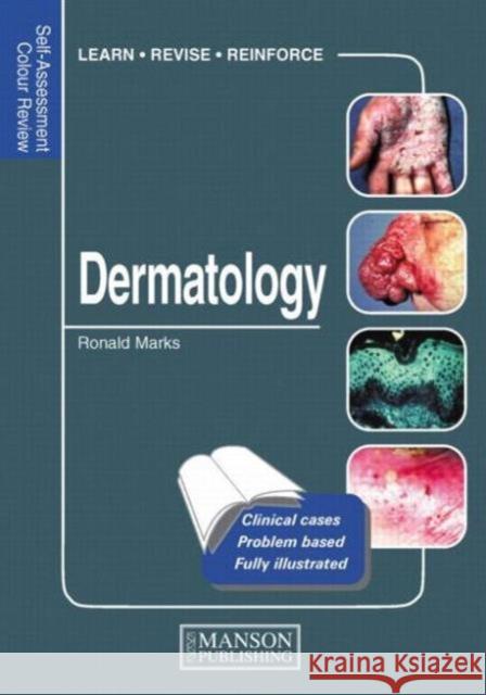 Dermatology: Self-Assessment Colour Review Marks, Ronald 9781840761665