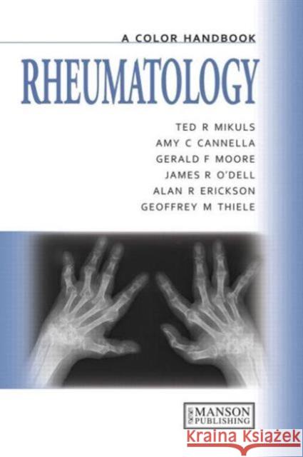 Rheumatology Mikuls, Ted 9781840761733 Manson Publishing