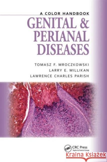 Genital and Perianal Diseases: A Color Handbook Mroczkowski, Tomasz F. 9781840761900 CRC Press