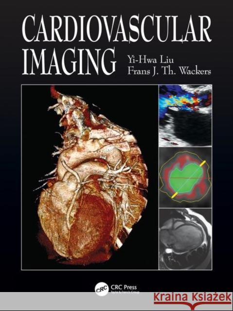 Cardiovascular Imaging Yi-Hwa Liu 9781840761917 0