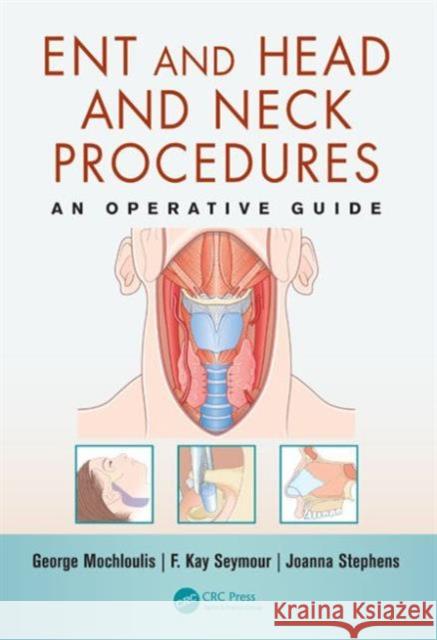 ENT and Head and Neck Procedures : An Operative Guide George Mochloulis F. Kay Seymour Joanna Stephens 9781840761962 CRC Press