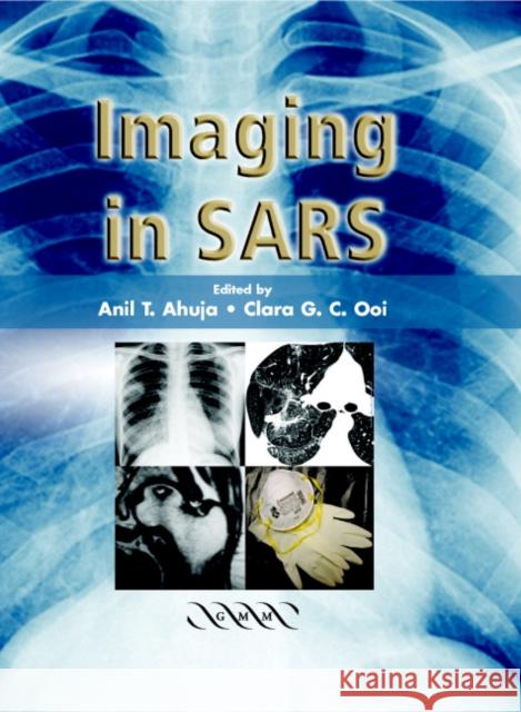 Imaging in Sars Ahuja, A. T. 9781841102191 Greenwich Medical Media