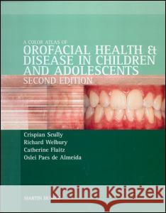 Color Atlas of Orofacial Health and Disease in Children and Adolescents : Diagnosis and Management, Second Edition Olei Paes De Almeida 9781841841021 TAYLOR & FRANCIS LTD