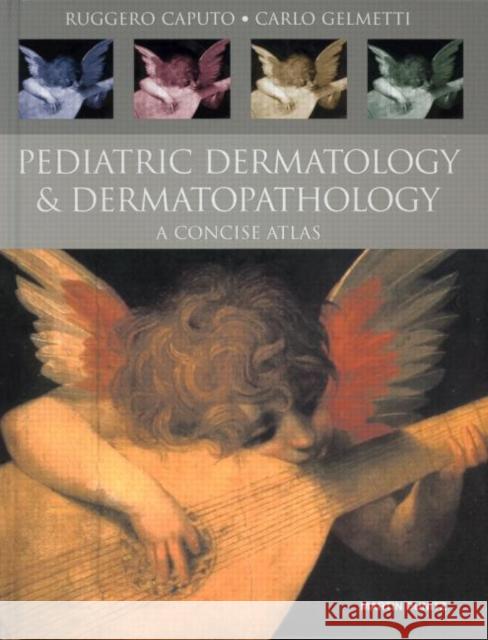 Pediatric Dermatology and Dermatopathology: A Concise Atlas Caputo, Ruggero 9781841841205 Taylor & Francis Group