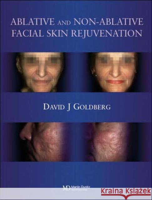 Ablative and Non-Ablative Facial Skin Rejuvenation Goldberg, David J. 9781841841755 TAYLOR & FRANCIS LTD