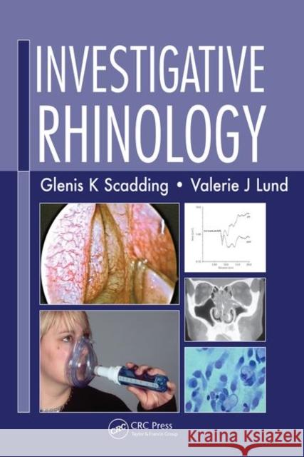 Investigative Rhinology Valerie J. Lund G. K. Scadding 9781841841977 TAYLOR & FRANCIS LTD