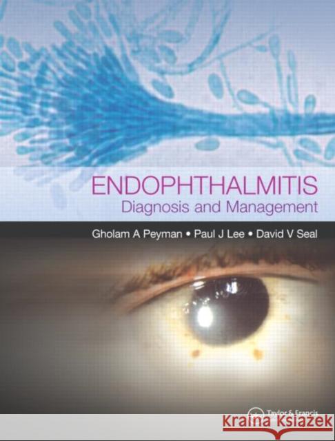 Endophthalmitis: Diagnosis and Treatment Lee, Paul J. 9781841842783 Taylor & Francis Group