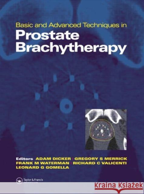Basic and Advanced Techniques in Prostate Brachytherapy Adam Dicker Gregory Merrick Leonard Gomella 9781841842981 Taylor & Francis Group