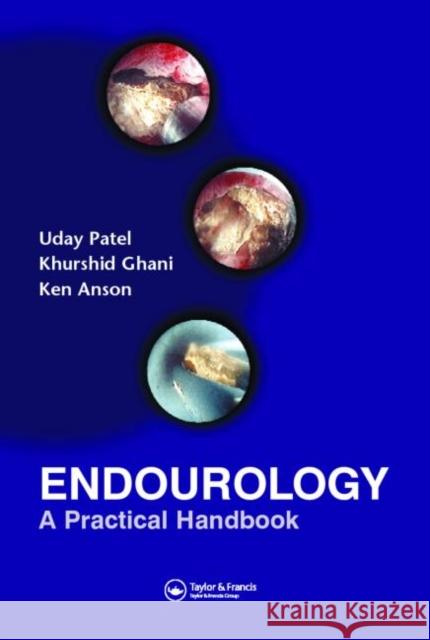 Endourology: A Practical Handbook Patel, Uday 9781841843391 Taylor & Francis Group