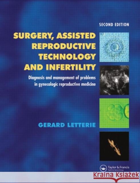 Surgery, Assisted Reproductive Technology and Infertility: Diagnosis and Management of Problems in Gynecologic Reproductive Medicine Letterie, Gerard S. 9781841843414 Taylor & Francis Group