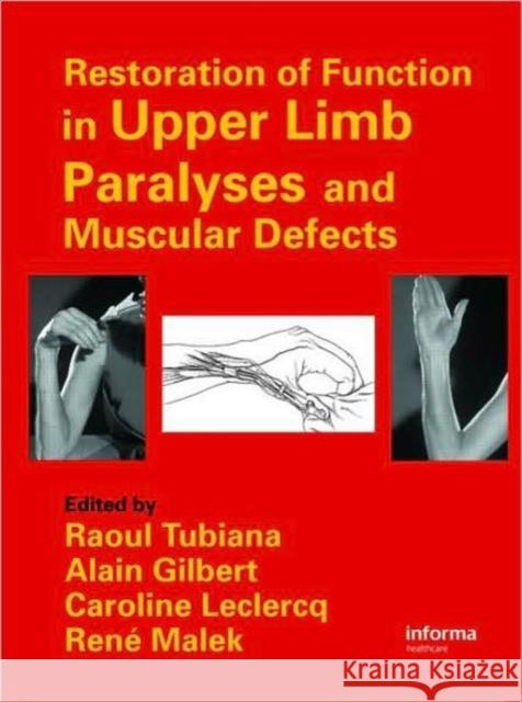 Restoration of Function in Upper Limb Paralyses and Muscular Defects Raoul Tubiana Tubiana Tubiana Raoul Tubiana 9781841843810 Informa Healthcare