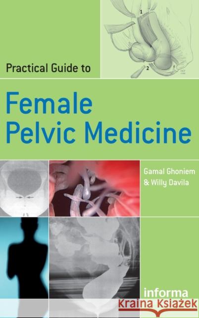 Practical Guide to Female Pelvic Medicine Gamal M. Ghoniem Ghoniem M. Ghoniem Gamal M. Ghoniem 9781841843988 Informa Healthcare