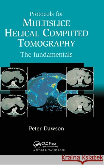 Protocols for Multislice Helical Computed Tomography: The Fundamentals Peter, Dawson 9781841844220