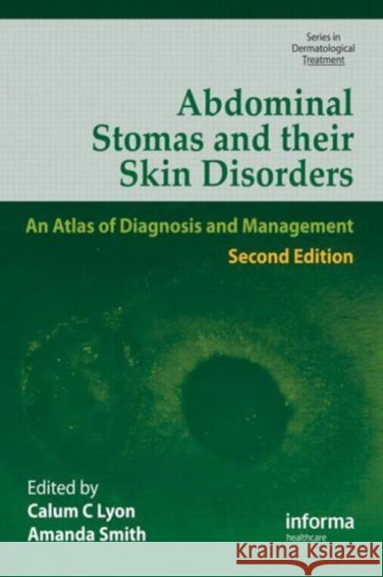 Abdominal Stomas and Their Skin Disorders Calum Lyon High Rising Calu Amanda Smith 9781841844312 Informa Healthcare