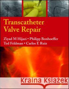 Transcatheter Valve Repair Ziyad M. Hijazi Carlos E. Ruiz Philipp Bonhoeffer 9781841844725 Informa Healthcare