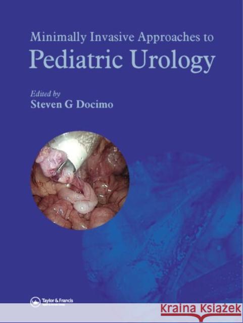 Minimally Invasive Approaches to Pediatric Urology Steven G. Docimo Docimo G. Docimo Steven G. Docimo 9781841845395 Informa Healthcare