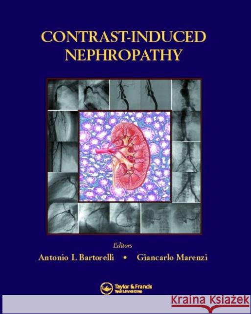 Contrast-Induced Nephropathy in Interventional Cardiovascular Medicine Antonio L. Bartorelli Giancarlo Marenzi Martin B. Leon 9781841845623