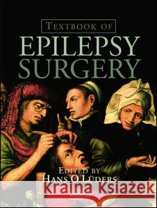 Textbook of Epilepsy Surgery Luders Luders Hans Luders William Bongaman 9781841845760 Informa Healthcare