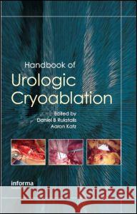 Handbook of Urologic Cryoablation Daniel B. Rukstalis Aaron Katz 9781841845777 Informa Healthcare