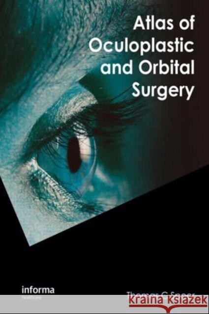 Atlas of Oculoplastic and Orbital Surgery Thomas C. Spoor 9781841845869 Informa Healthcare