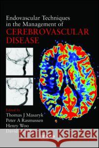 Endovascular Techniques in the Management of Cerebrovascular Disease Thomas J. Masaryk Masaryk J. Masaryk 9781841846071 Informa Healthcare