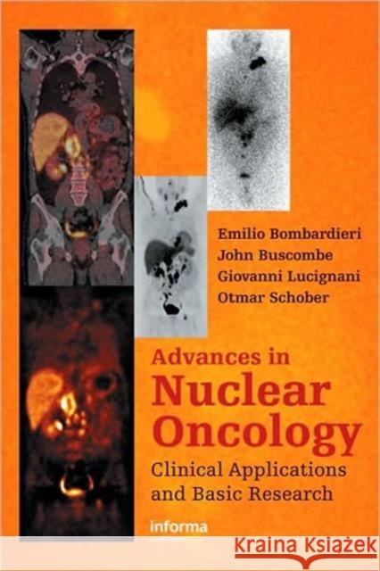 Advances in Nuclear Oncology:: Diagnosis and Therapy Bombardieri, Emilio 9781841846149 Informa Healthcare