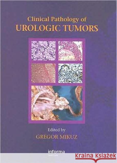 Clinical Pathology of Urological Tumours Gregor Mikuz Gregor Mikuz 9781841846194 Informa Healthcare