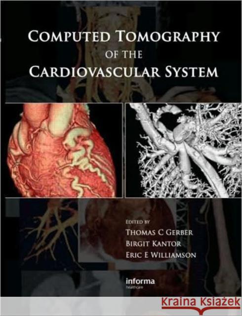 Computed Tomography of the Cardiovascular System Thomas C. Gerber Birgit Kantor Eric E. Williamson 9781841846255