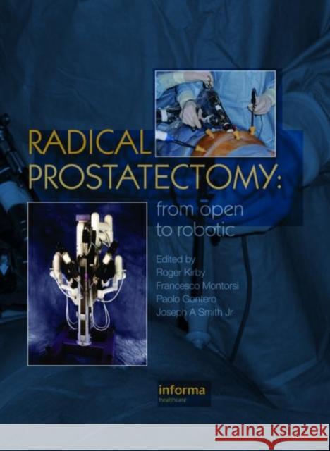 Radical Prostatectomy: From Open to Robotic Kirby, Roger 9781841846279