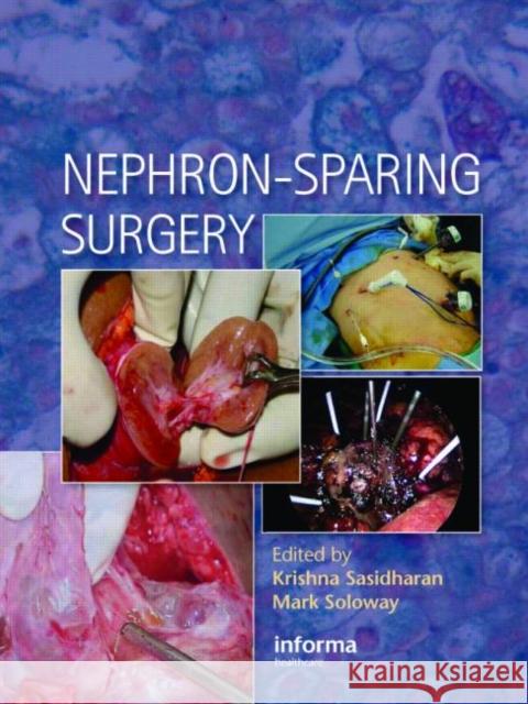 Nephron-Sparing Surgery K. Sasidharan Mark Soloway K. Sasidharan 9781841846361 Informa Healthcare