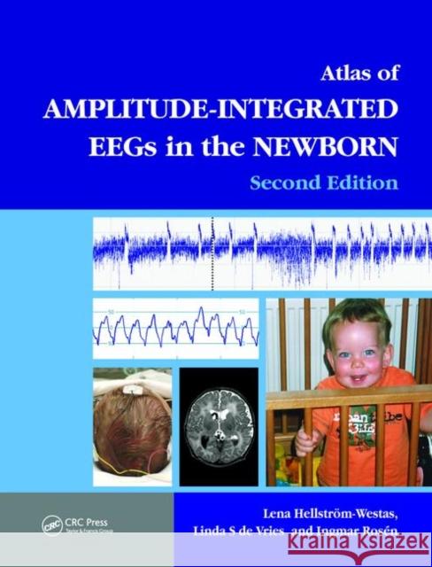 An Atlas of Amplitude-Integrated Eegs in the Newborn [With DVD ROM] Hellström-Westas, Lena 9781841846491 Informa Healthcare