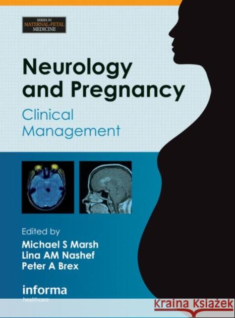 Neurology and Pregnancy: Clinical Management Marsh, Michael S. 9781841846521 Informa Healthcare