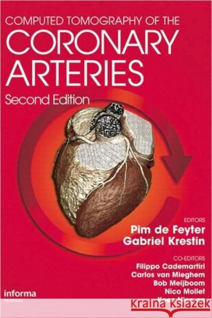 Computed Tomography of the Coronary Arteries Pim J. D G. P. Gabriel Krestin 9781841846576