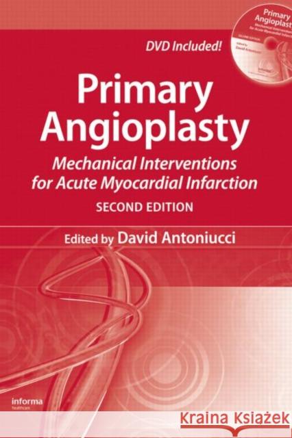 Primary Angioplasty: Mechanical Interventions for Acute Myocardial Infarction, Second Edition Antoniucci, David 9781841846620 Informa Healthcare