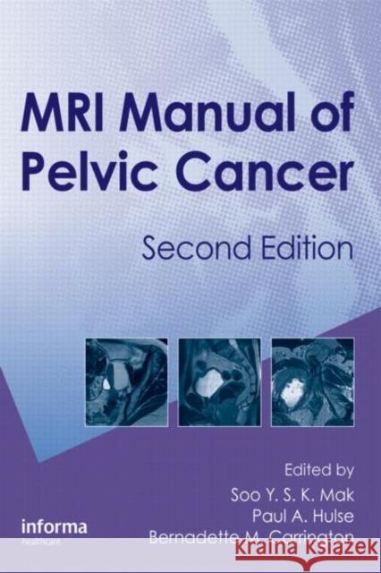 MRI Manual of Pelvic Cancer Mak, Soo 9781841846767 Informa Healthcare