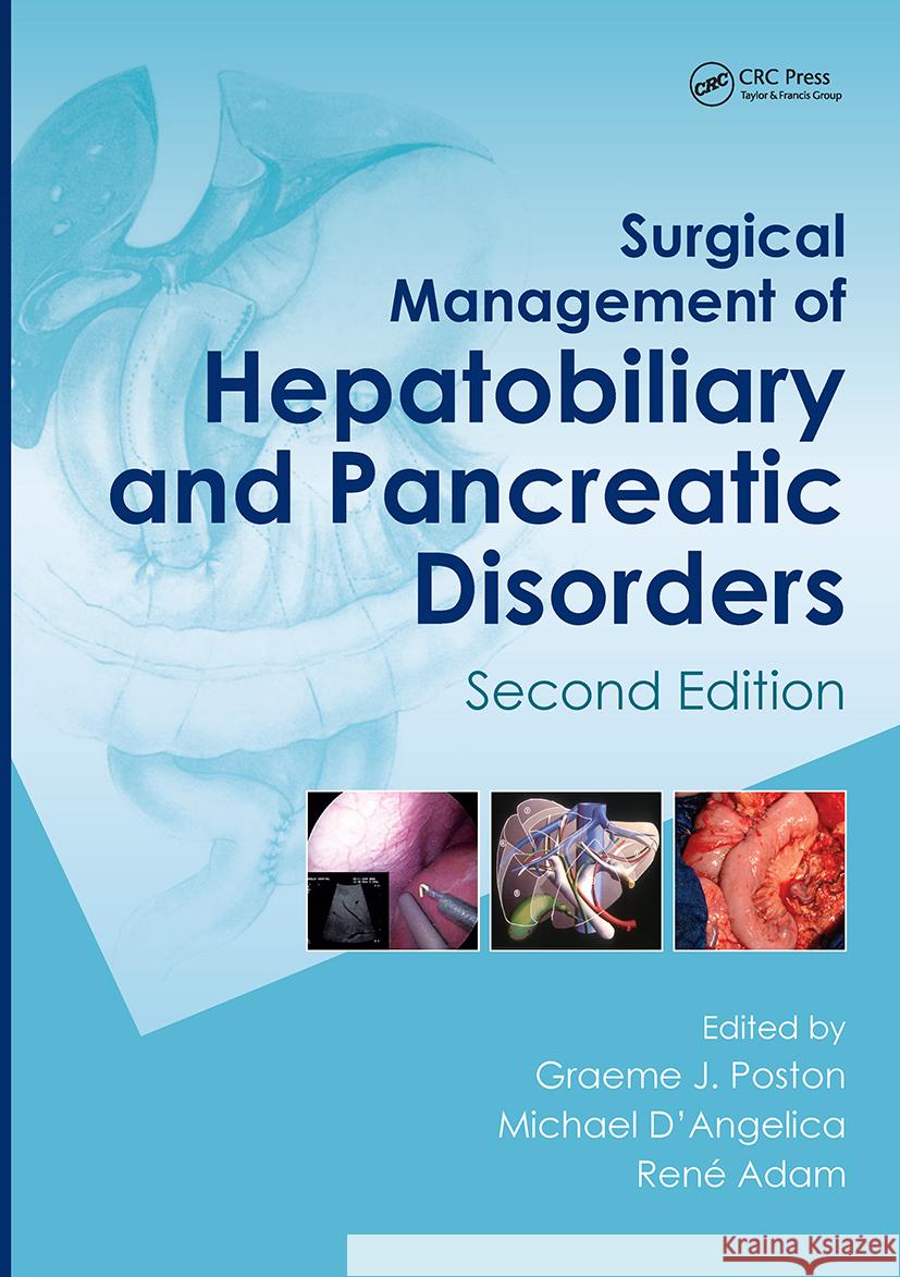 Surgical Management of Hepatobiliary and Pancreatic Disorders, Second Edition  9781841846934 