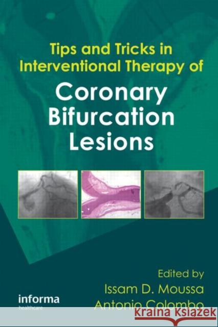 Tips and Tricks in Interventional Therapy of Coronary Bifurcation Lesions Issam Moussa Antonio Colombo 9781841847269 Informa Healthcare