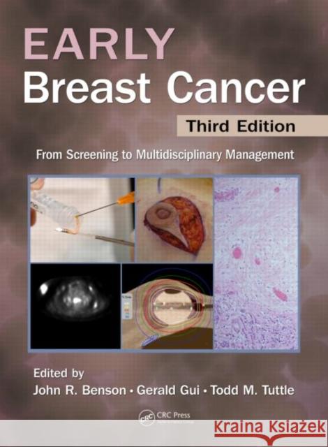 Early Breast Cancer: From Screening to Multidisciplinary Management, Third Edition Benson, John R. 9781841848853 Informa Healthcare