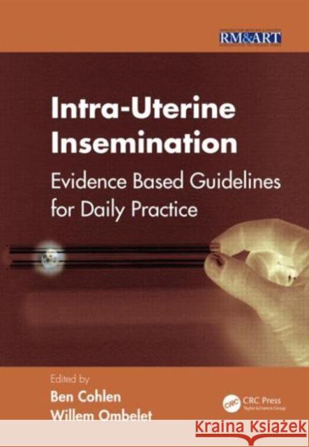 Intra-Uterine Insemination: Evidence Based Guidelines for Daily Practice Cohlen, Ben 9781841849881 Informa Healthcare