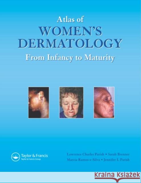 Atlas of Women's Dermatology: From Infancy to Maturity Parish MD, Lawrence Charles 9781842142080 Taylor & Francis Group