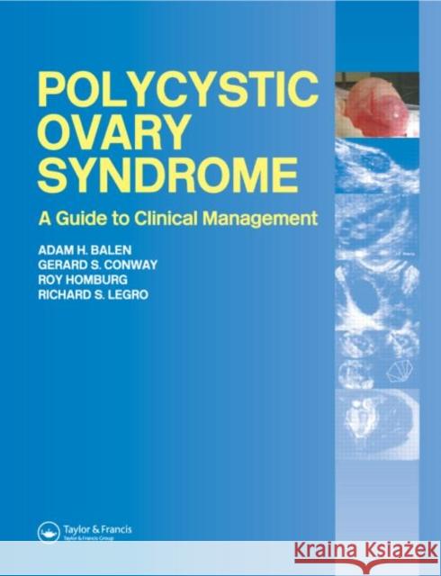 Polycystic Ovary Syndrome: A Guide to Clinical Management Balen, Adam H. 9781842142110 Taylor & Francis Group