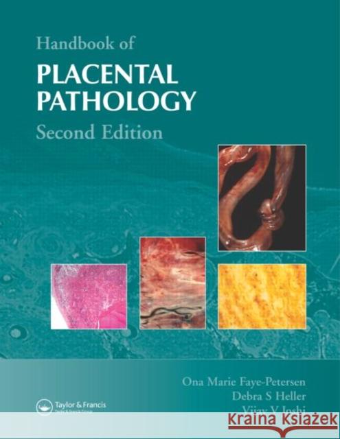 Handbook of Placental Pathology Ona Marie Faye-Petersen Debra S. Heller Vijay V. Joshi 9781842142325 Taylor & Francis Group