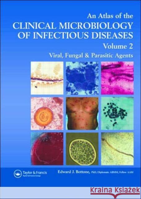 Atlas of the Clinical Microbiology of Infectious Diseases: Viral, Fungal and Parasitic Agents Bottone, Edward J. 9781842142400 Taylor & Francis Group