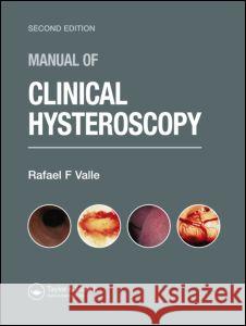 Manual of Clinical Hysteroscopy, Second Edition Valle, Rafael F. 9781842142592 Taylor & Francis Group