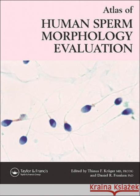 Atlas of Human Sperm Morphology Evaluation Raymond Bonnett Thinus F. Kruger Daniel R. Franken 9781842142776 Taylor & Francis Group