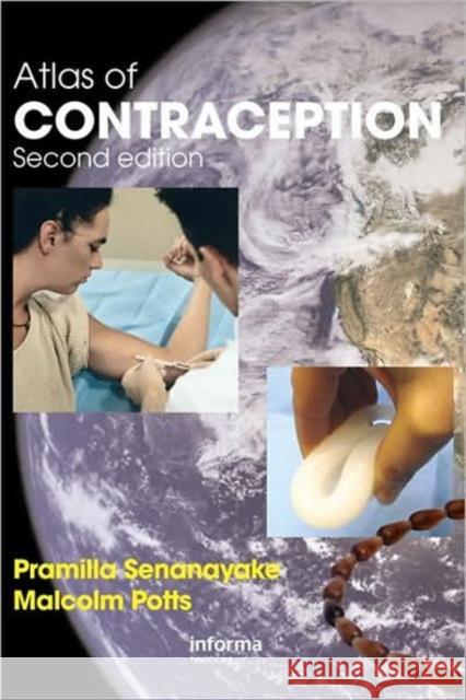 Atlas of Contraception I. Prami Senanayake Senanayake Pramilla Senanayake Malcolm Potts 9781842143056 Informa Healthcare