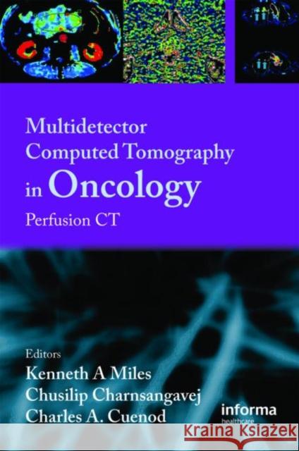 Multi-Detector Computed Tomography in Oncology: CT Perfusion Imaging Miles, Kenneth 9781842143094 Informa Healthcare